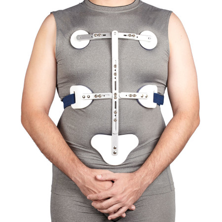 Hyperextension Orthosis